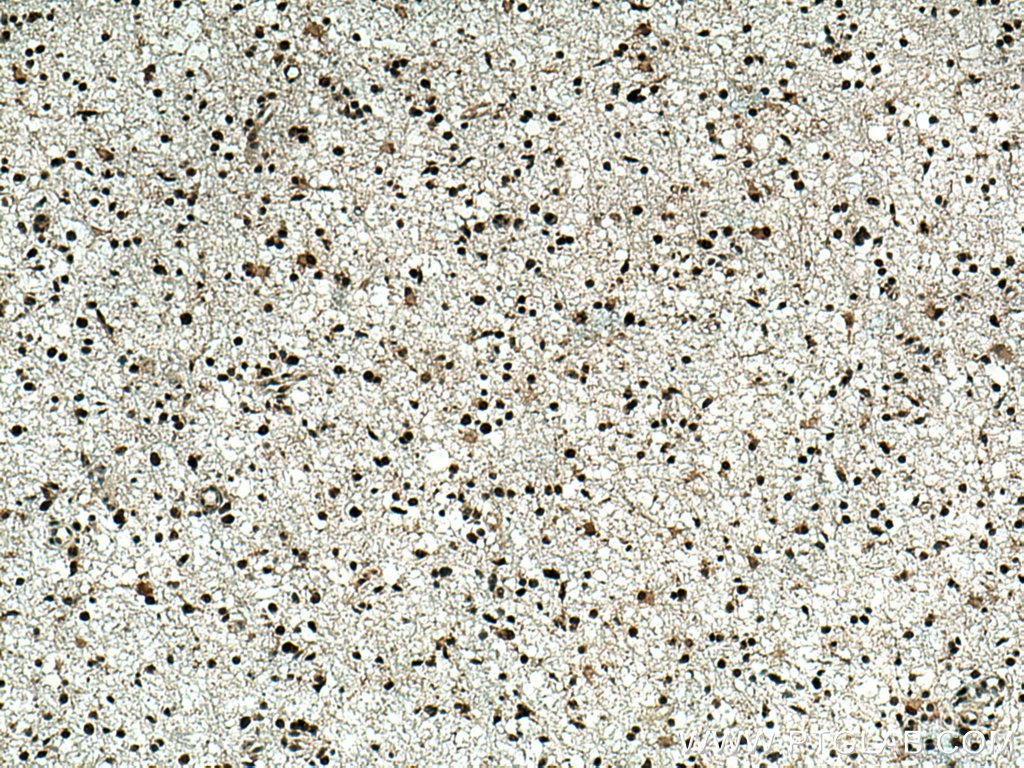 TERF2 Polyclonal antibody