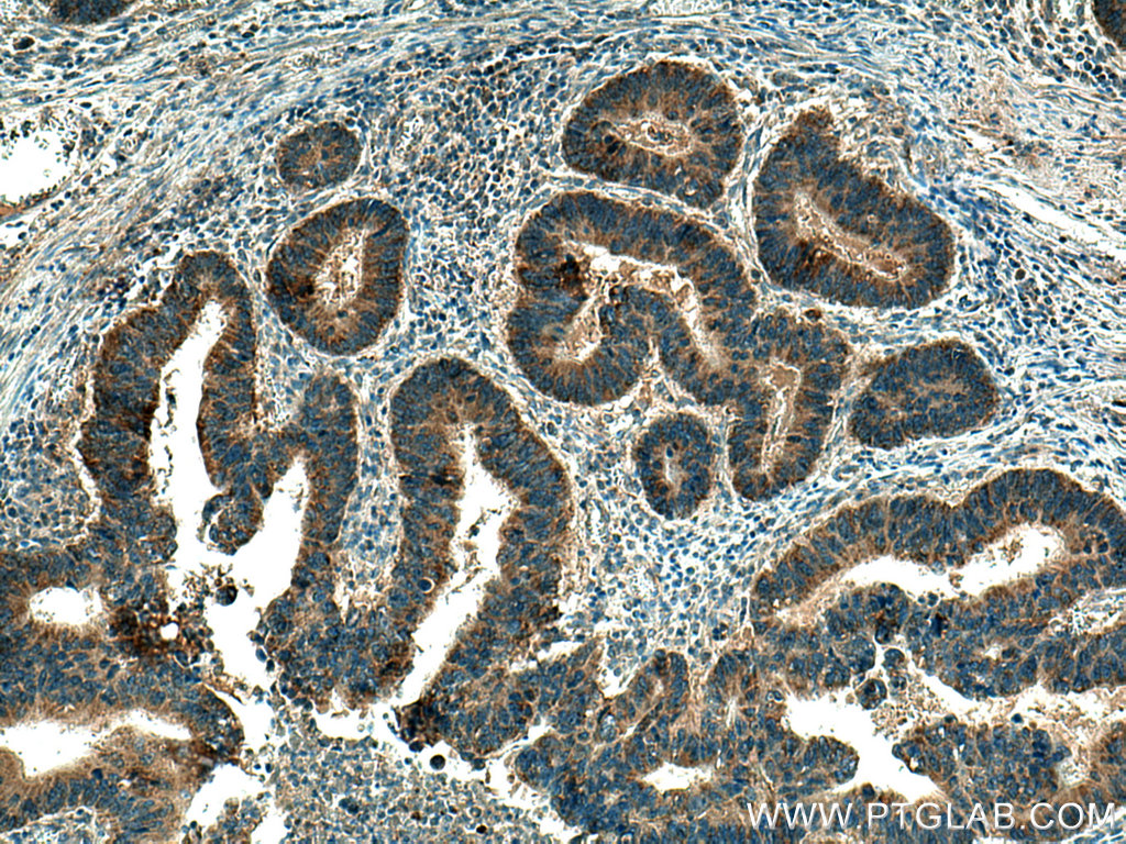 B9D2 Polyclonal antibody