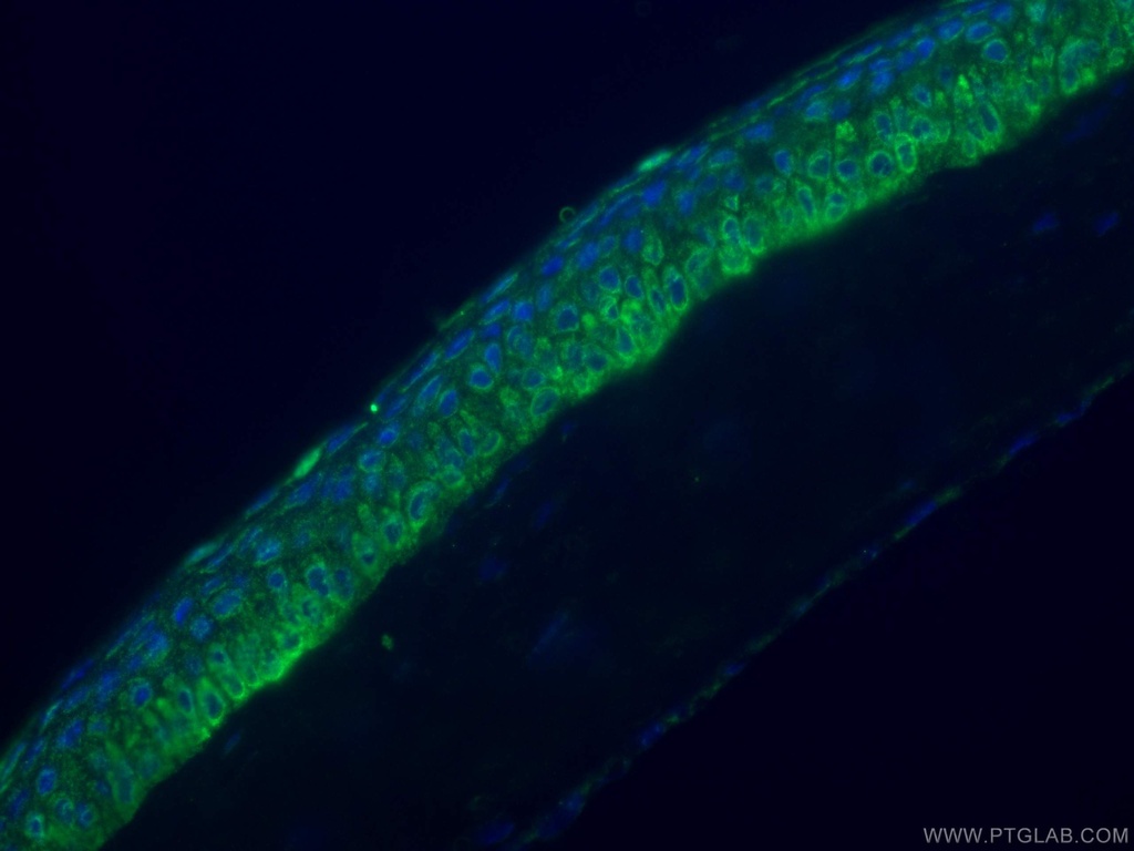 PDE6B Polyclonal antibody