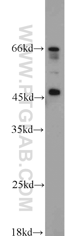 PRDM7 Polyclonal antibody