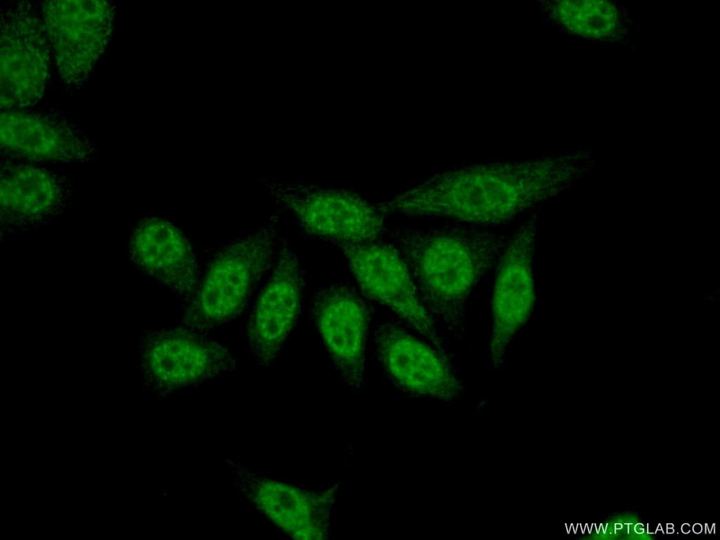 TLE3 Polyclonal antibody