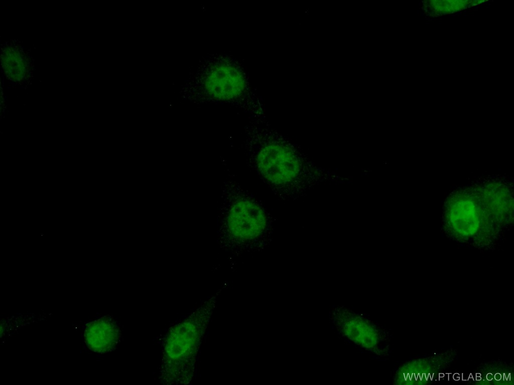 AP1,JUN,P39 Polyclonal antibody