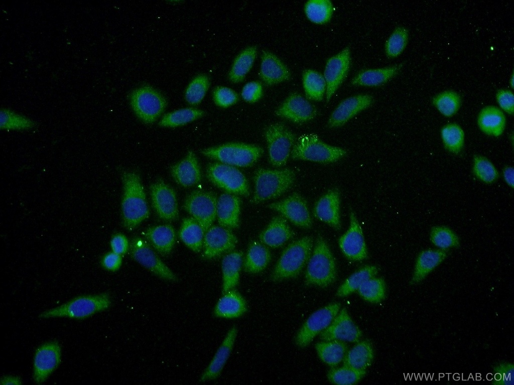 Ubiquilin 1 Polyclonal antibody