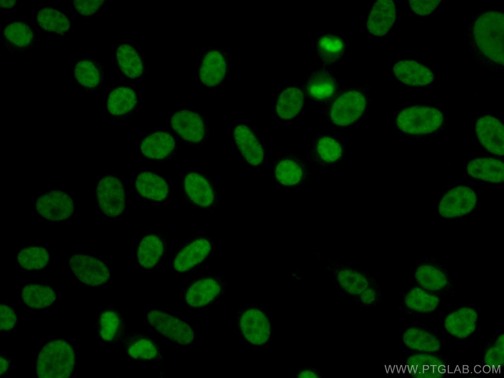 YY1 Polyclonal antibody