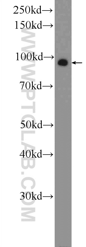 ZNF287 Polyclonal antibody