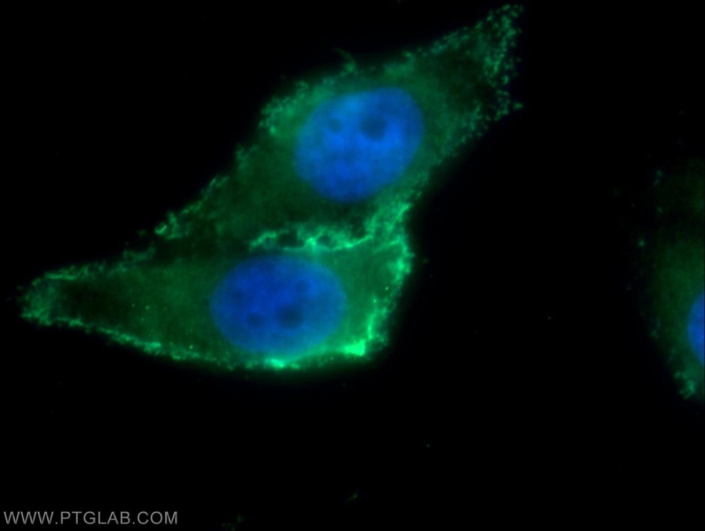 ARHGAP21 Polyclonal antibody