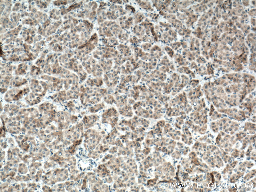 BMP3 Polyclonal antibody
