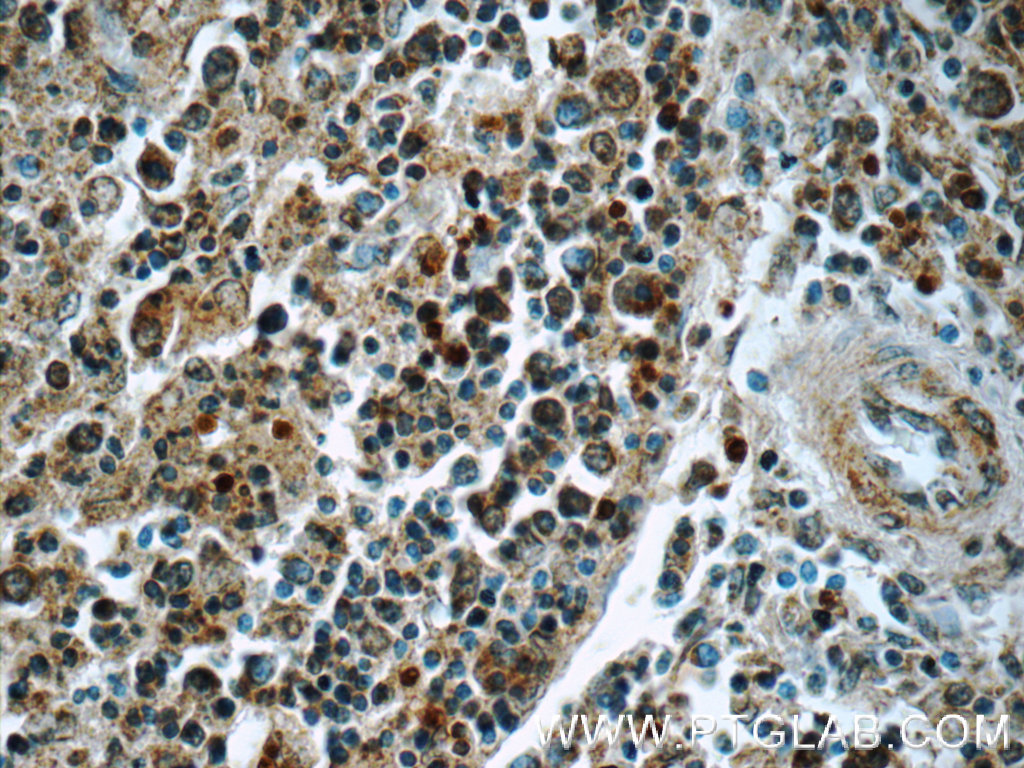 SYK Polyclonal antibody