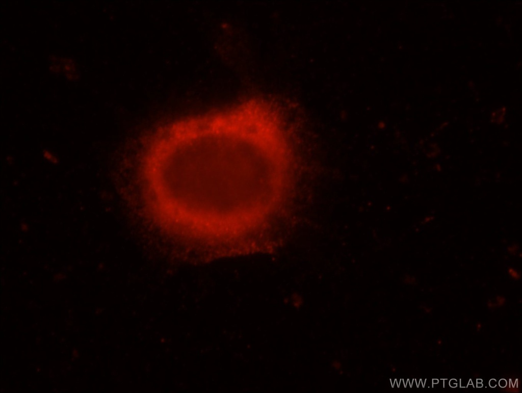 ERC1 Polyclonal antibody