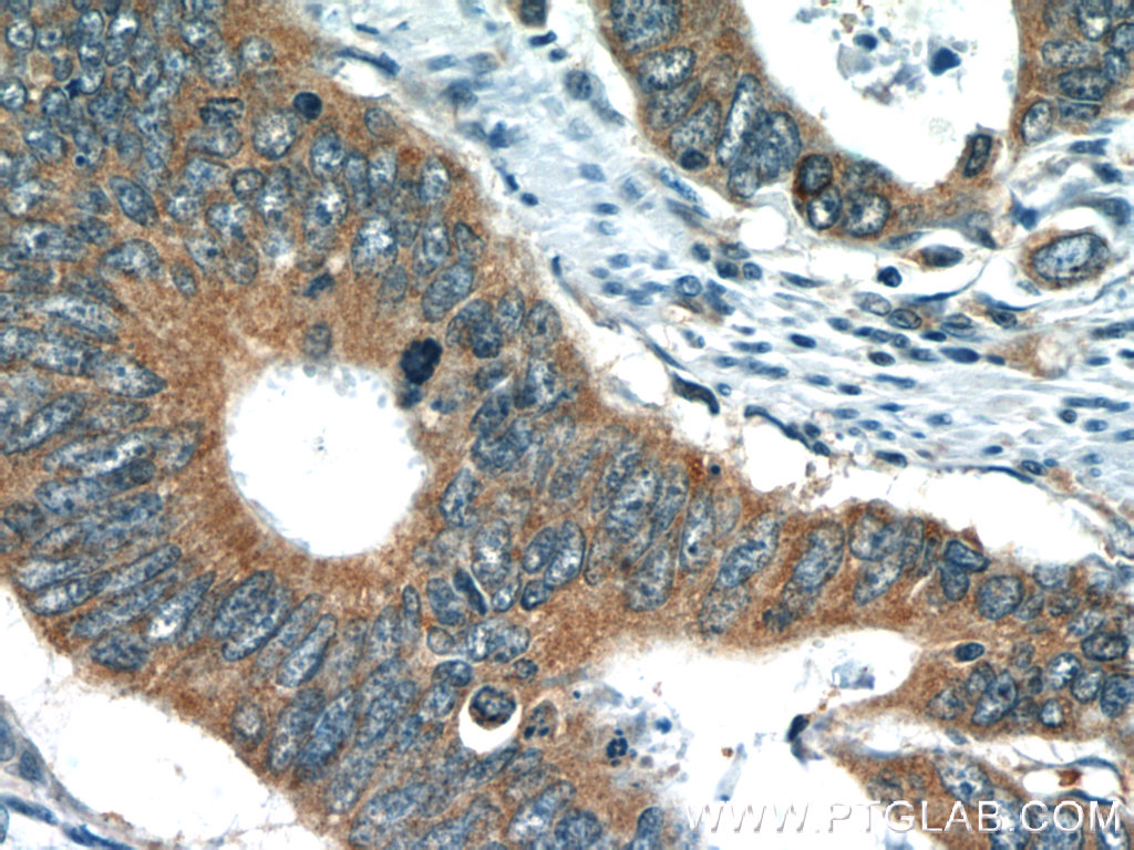 TMF1 Polyclonal antibody
