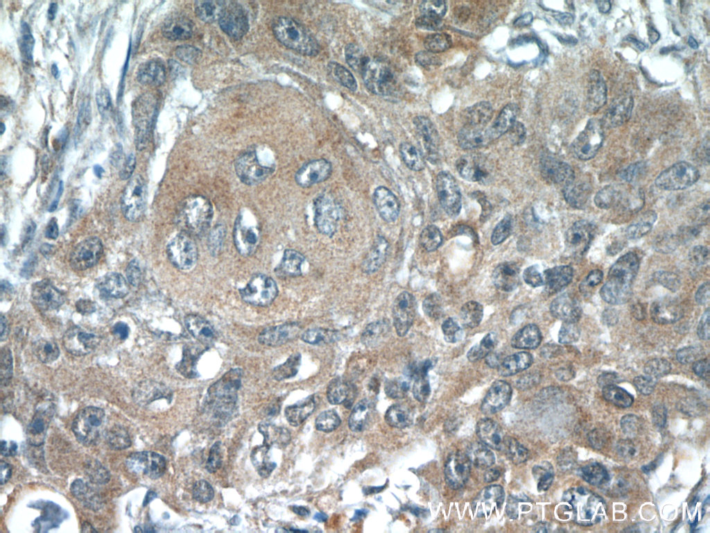 ACP1 Polyclonal antibody