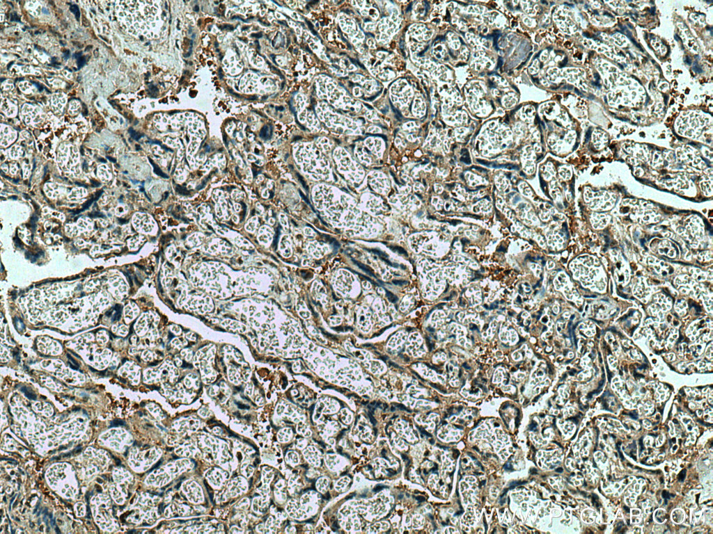 CSE1L Polyclonal antibody