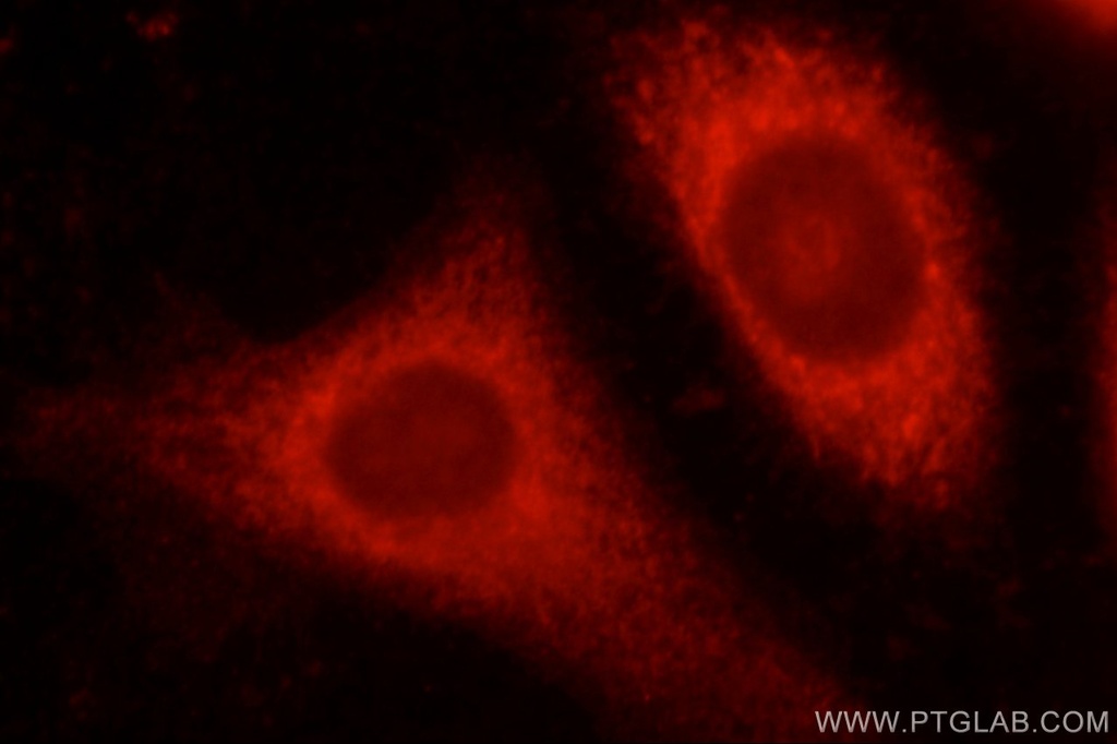 ALDH1B1 Polyclonal antibody