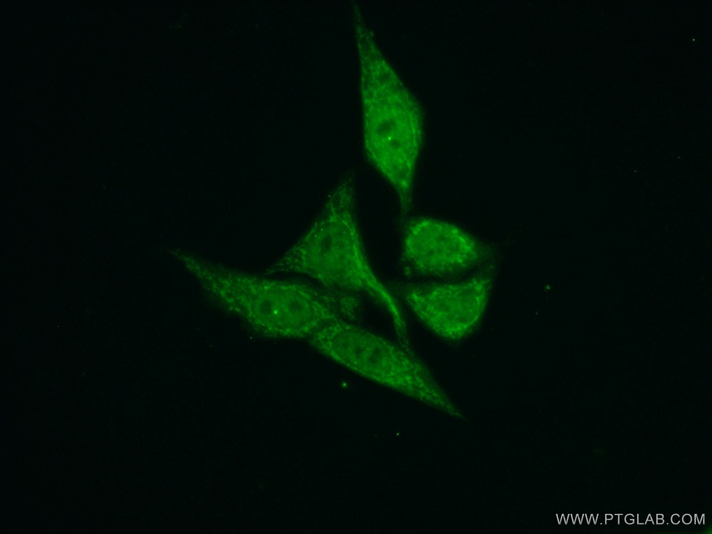 TIMM50 Polyclonal antibody