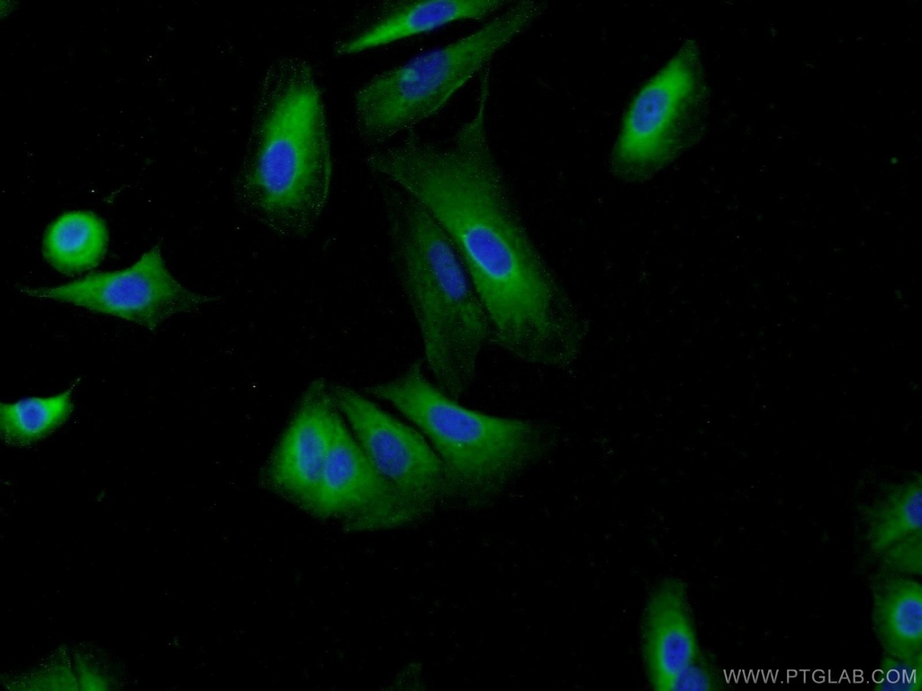 HIP1 Polyclonal antibody