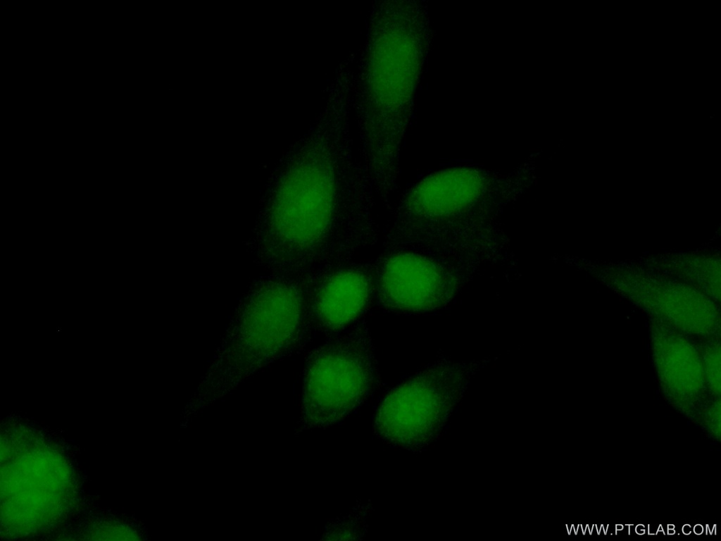 BRD2 Polyclonal antibody