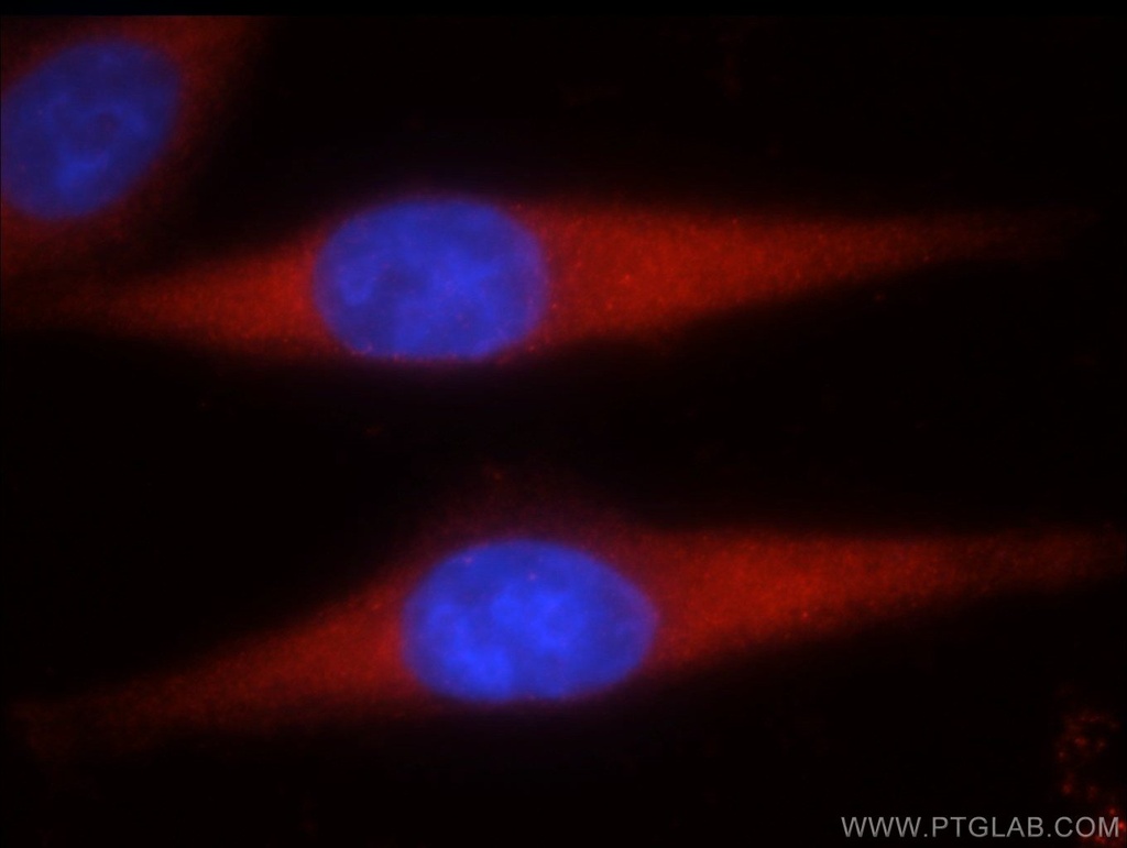 STK4/MST1 Polyclonal antibody