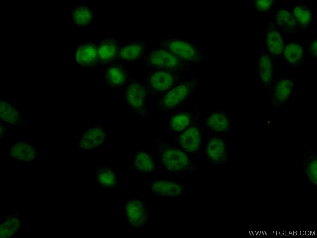 ASF1B-specific Polyclonal antibody