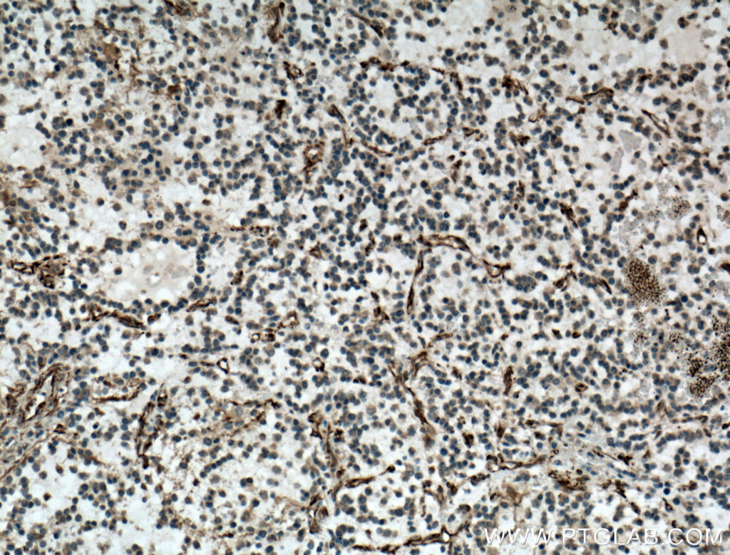 SACS Polyclonal antibody