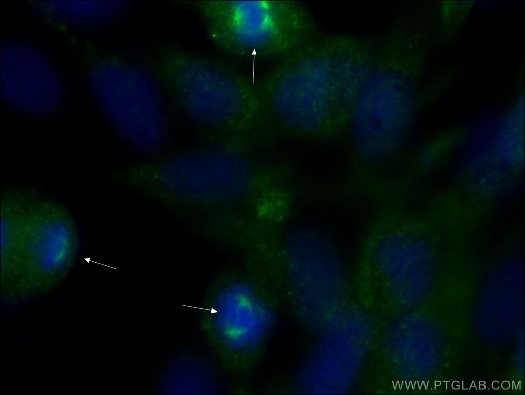 Pericentrin Polyclonal antibody