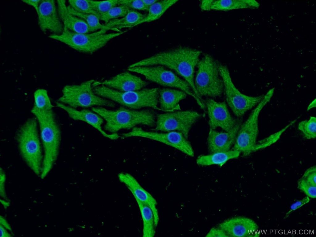 CACNA1D Polyclonal antibody