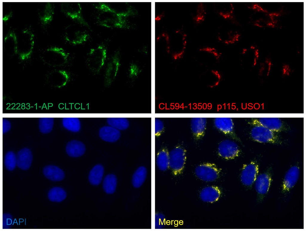 CLTCL1 Polyclonal antibody