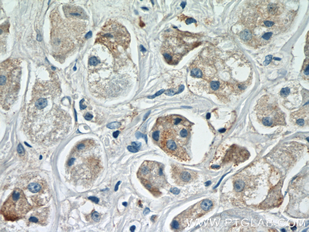 ARF3 Polyclonal antibody