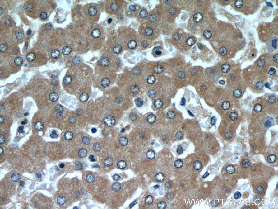 SAR1B Polyclonal antibody