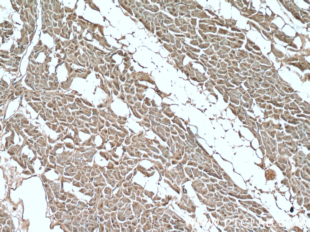CCL18/MIP-4 Polyclonal antibody