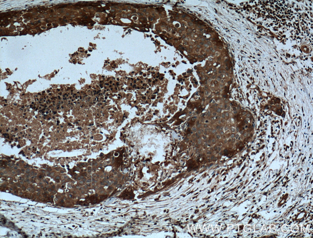 CCL24/Eotaxin 2 Polyclonal antibody