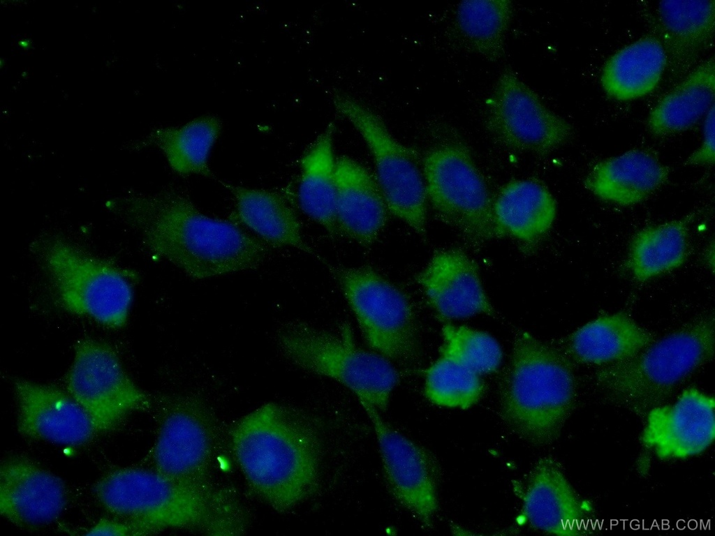 TGF Alpha Polyclonal antibody