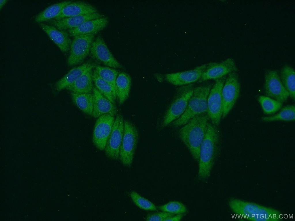 SMN Polyclonal antibody