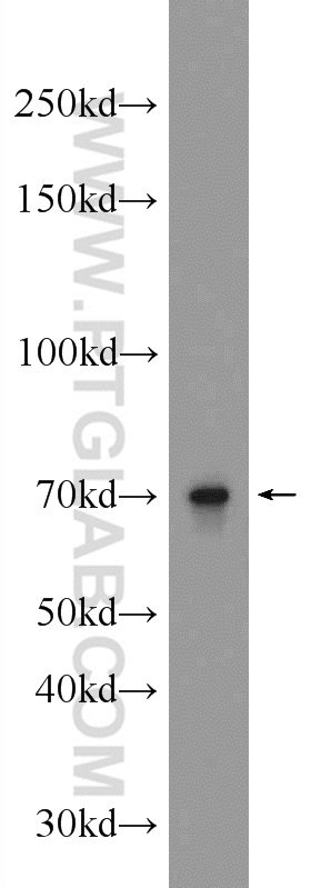 ALX3 Polyclonal antibody