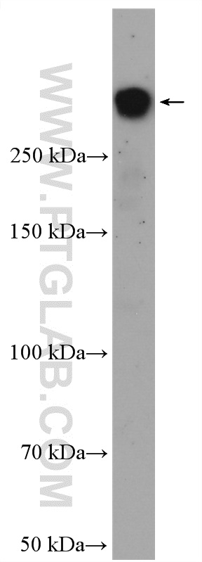 BRCA1 Polyclonal antibody