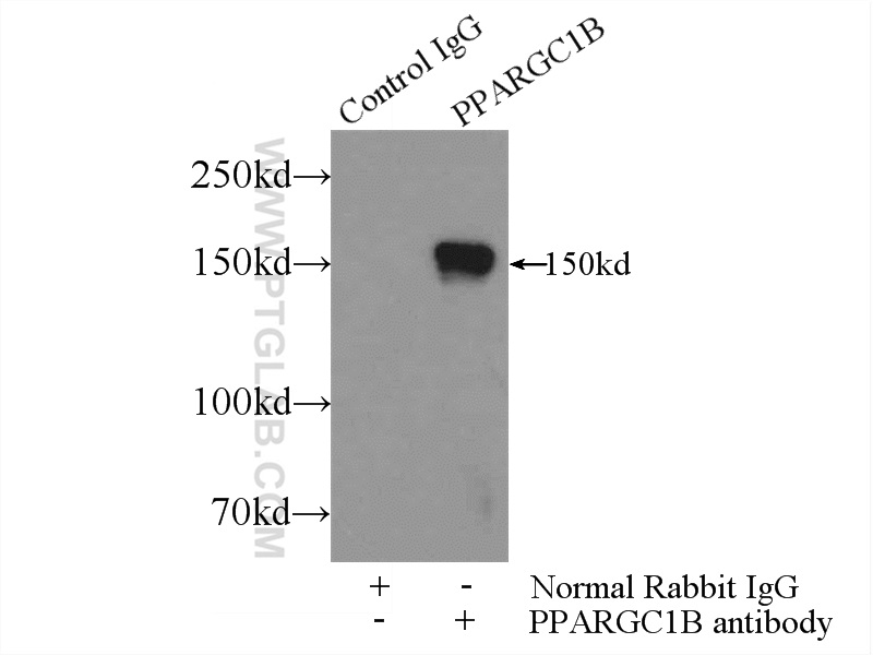 PPARGC1B Polyclonal antibody