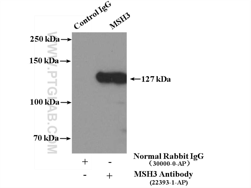 MSH3 Polyclonal antibody