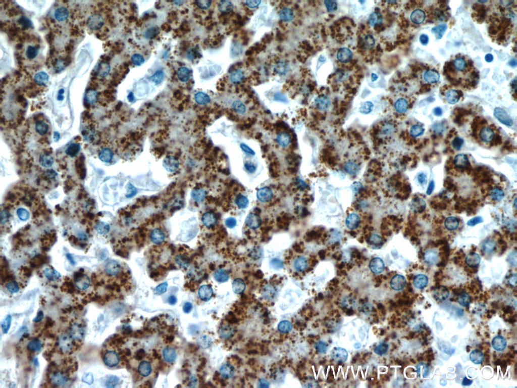 AGXT Polyclonal antibody