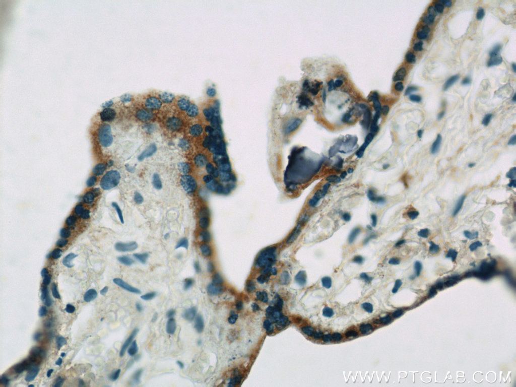 ACSL4/FACL4 Polyclonal antibody