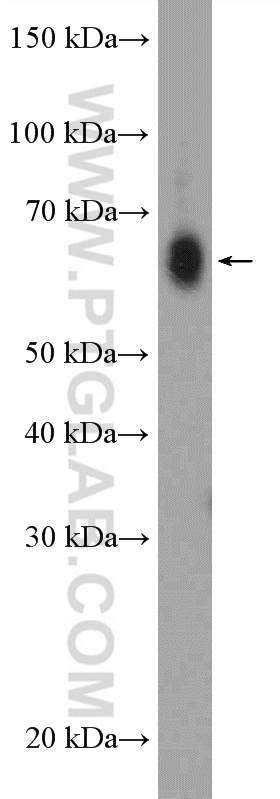 ZCCHC7 Polyclonal antibody
