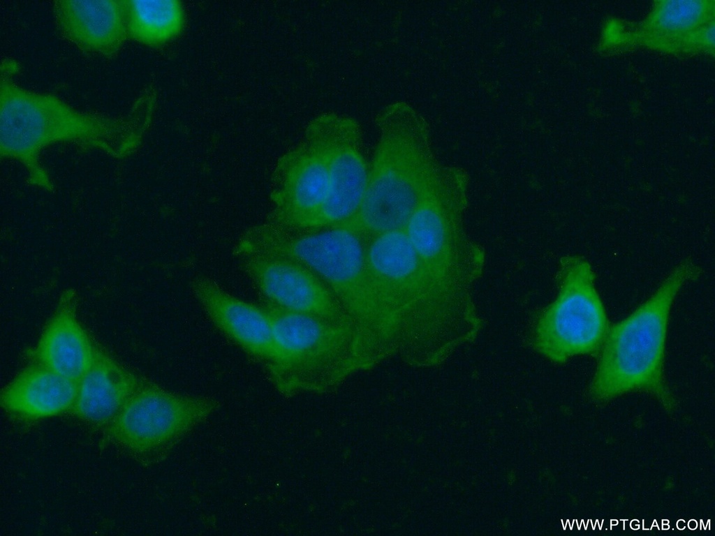 ERBB2IP Polyclonal antibody