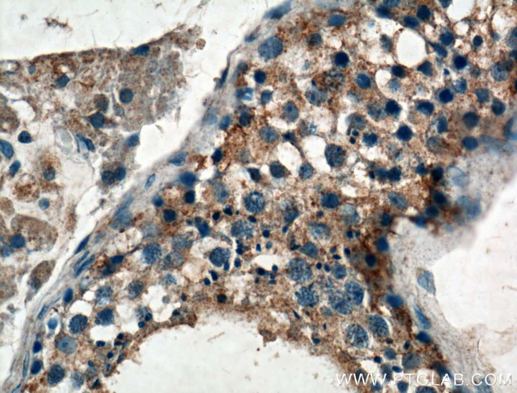 GNRHR Polyclonal antibody