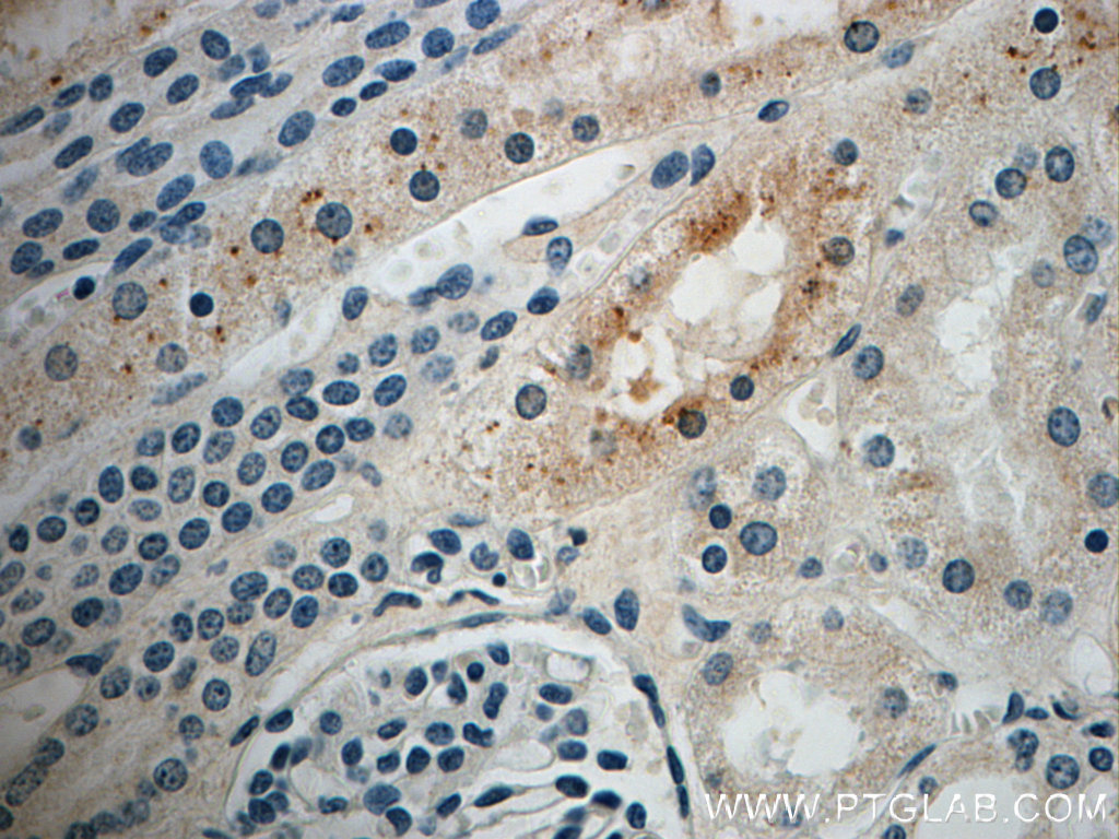 SRGAP2 Polyclonal antibody