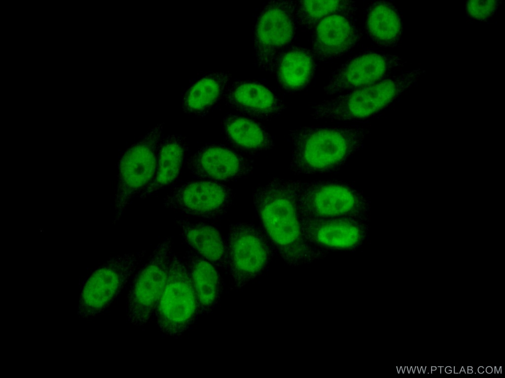 ELF1 Polyclonal antibody