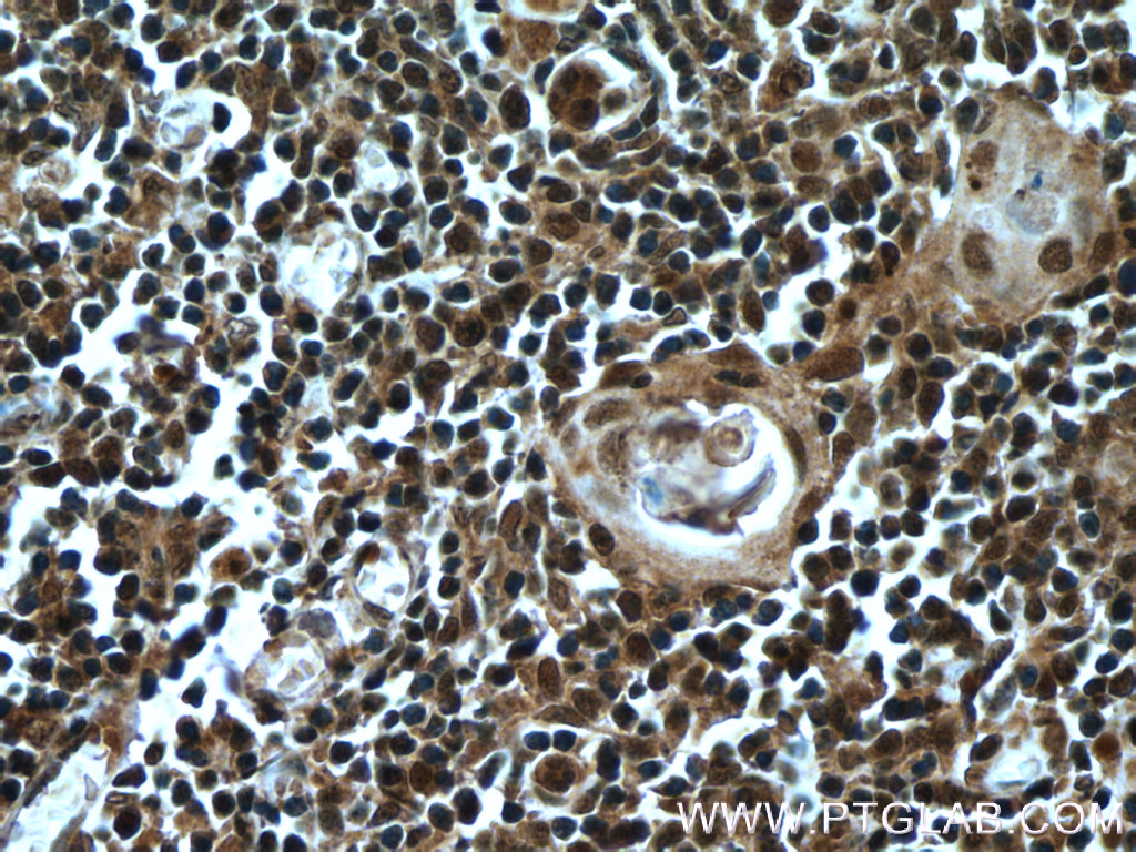 KDM4D Polyclonal antibody
