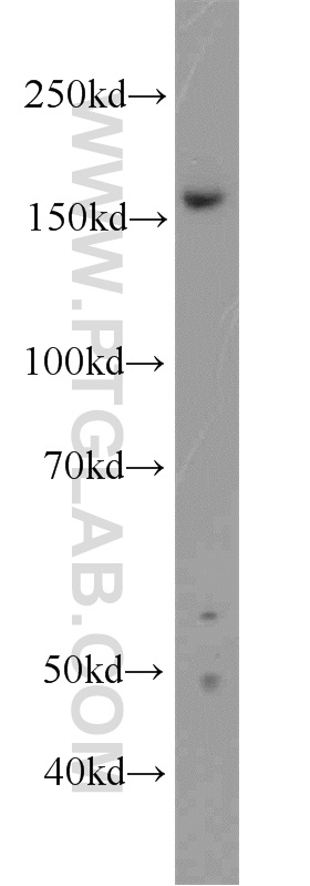 ZZZ3 Polyclonal antibody