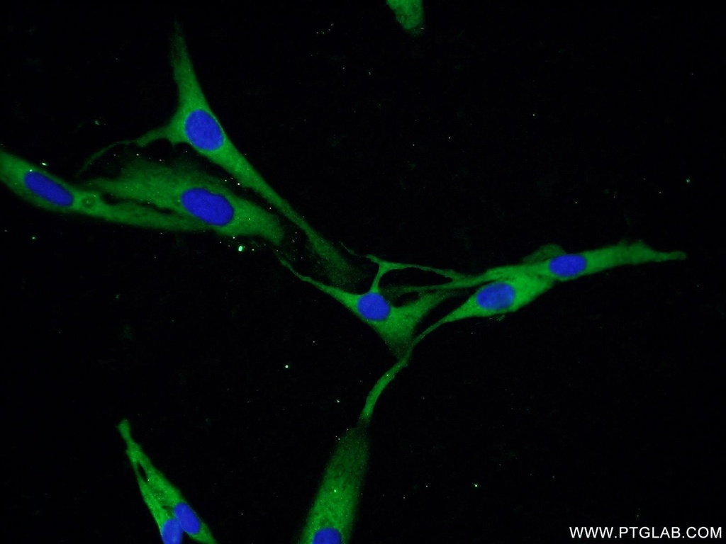 PDE5A Polyclonal antibody