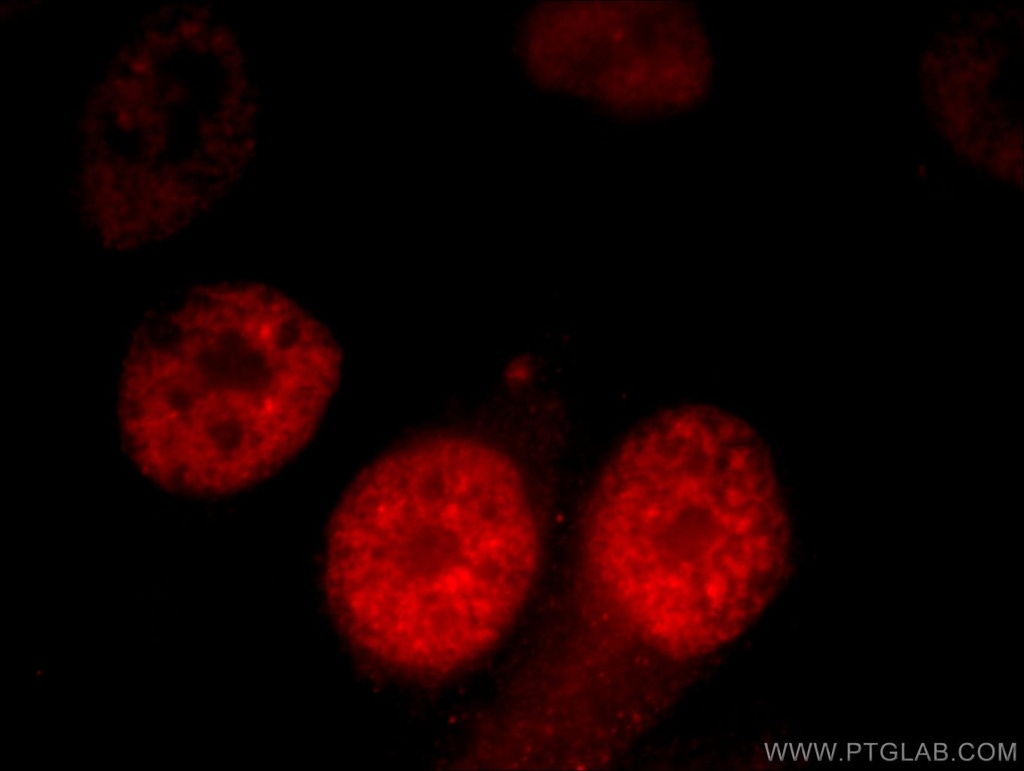 CCAR2 Polyclonal antibody