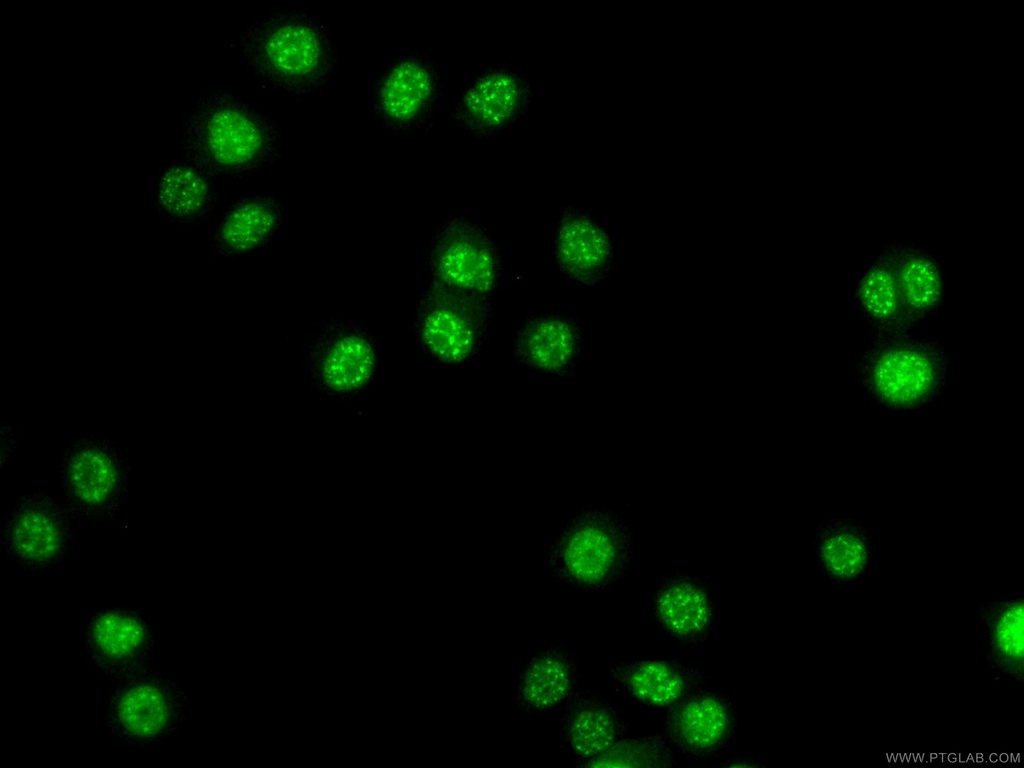ATOX1 Polyclonal antibody