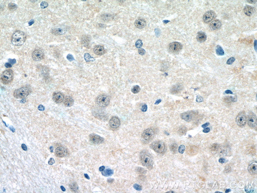 HES5 Polyclonal antibody