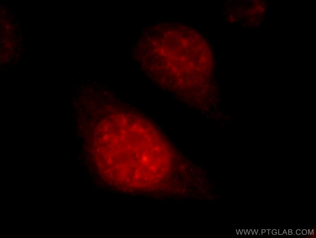 SART1 Polyclonal antibody
